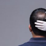 hair-restoration-torrance-hair-loss-treatment-med-spa-near-me